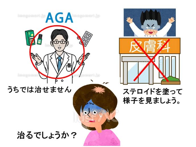 円形脱毛症　病院